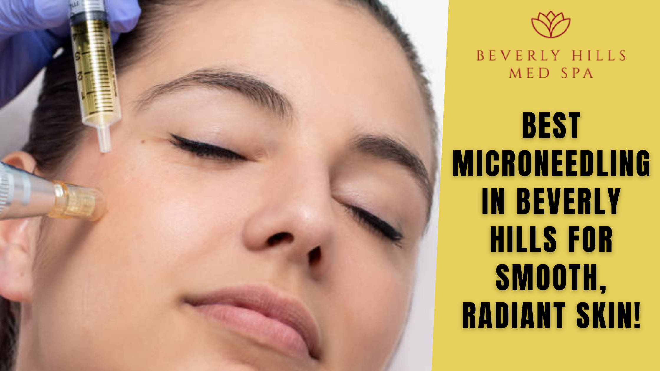 microneedling in beverly hills